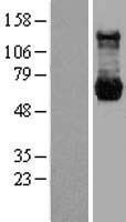 PPM1G Human Over-expression Lysate