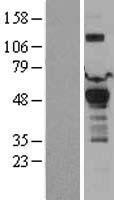 PDK1 Human Over-expression Lysate