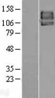 PDGF Receptor beta (PDGFRB) Human Over-expression Lysate
