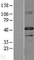 PBX1 Human Over-expression Lysate