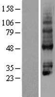 P2Y4 (P2RY4) Human Over-expression Lysate