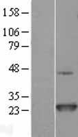 NRAS Human Over-expression Lysate