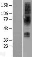 NMBR Human Over-expression Lysate