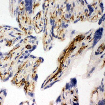Anti-CD31/PECAM1 Antibody
