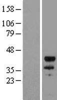 MYOD1 Human Over-expression Lysate