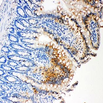 Anti-Caspase-3(P17)/CASP3 Antibody