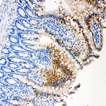 Caspase-3(P17)/CASP3 Antibody