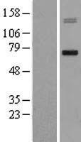 MMP15 Human Over-expression Lysate