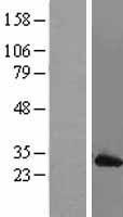 MAD2 (MAD2L1) Human Over-expression Lysate