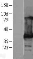 Lactate Dehydrogenase B (LDHB) Human Over-expression Lysate