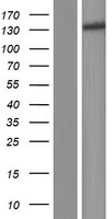 JAK1 Human Over-expression Lysate