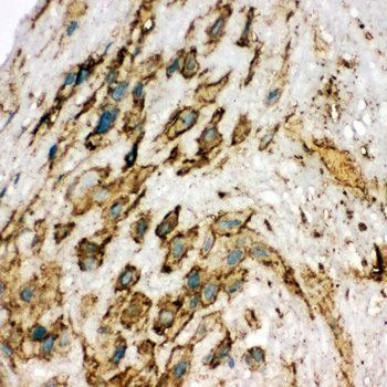 Anti-VEGF Receptor 2/KDR Antibody