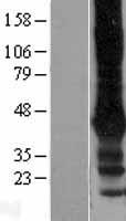 GIRK2 (KCNJ6) Human Over-expression Lysate