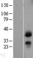 CD82 Human Over-expression Lysate
