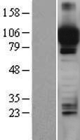 ITIH4 Human Over-expression Lysate