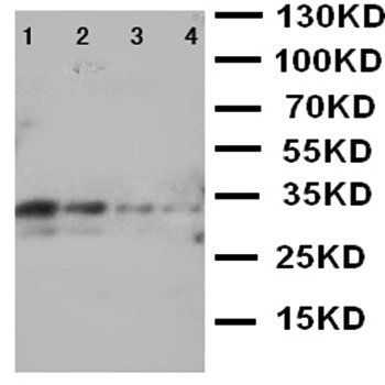 Anti-LTK Antibody