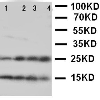 Nucleoplasmin-2 NPM2 Antibody