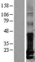 ID1 Human Over-expression Lysate