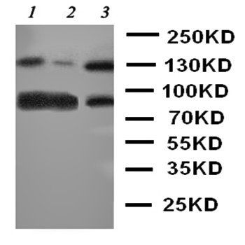 TrkC/NTRK3 Antibody