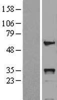 HOXB5 Human Over-expression Lysate