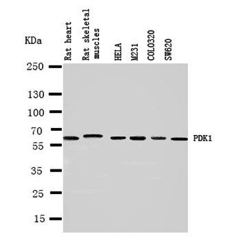 Anti-Mitochondrial Pyruvate dehydrogenase kinase 1/PDK1 Antibody