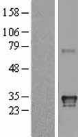HLADQA1 (HLA-DQA1) Human Over-expression Lysate