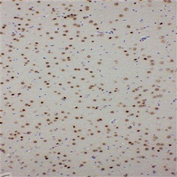 Anti-PDK2 Antibody