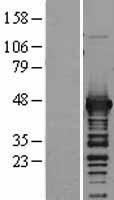 Aspartate Aminotransferase (GOT1) Human Over-expression Lysate