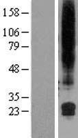 GML Human Over-expression Lysate