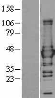 Glutamine Synthetase (GLUL) Human Over-expression Lysate