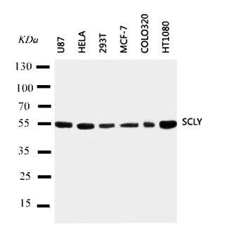 Selenocysteine lyase SCLY Antibody