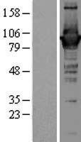 GBP1 Human Over-expression Lysate