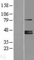 FDPS Human Over-expression Lysate