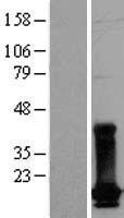 DUT Human Over-expression Lysate