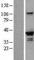DHPS Human Over-expression Lysate