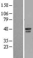 Casein Kinase 1 delta (CSNK1D) Human Over-expression Lysate
