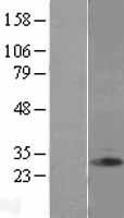 Clathrin light chain (CLTB) Human Over-expression Lysate
