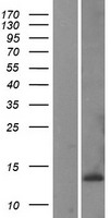CKS1 (CKS1B) Human Over-expression Lysate