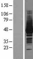 Creatine kinase M type (CKM) Human Over-expression Lysate