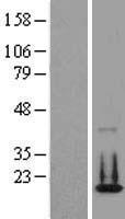 CENPA Human Over-expression Lysate