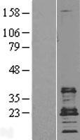 CD9 Human Over-expression Lysate