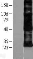 CD97 (ADGRE5) Human Over-expression Lysate