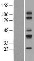 CD79A Human Over-expression Lysate
