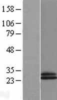 CD69 Human Over-expression Lysate