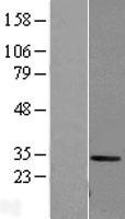 Carbonic Anhydrase I (CA1) Human Over-expression Lysate
