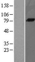 C1S Human Over-expression Lysate