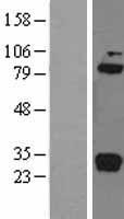 C1R Human Over-expression Lysate