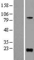 BTG1 Human Over-expression Lysate