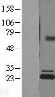ATP5PB Human Over-expression Lysate
