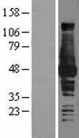 BHMT Human Over-expression Lysate